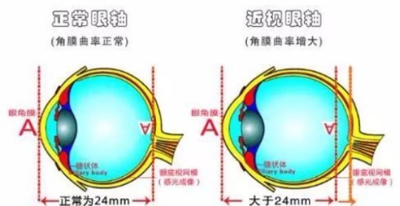 开学季，家长必须注意的近视防控误区