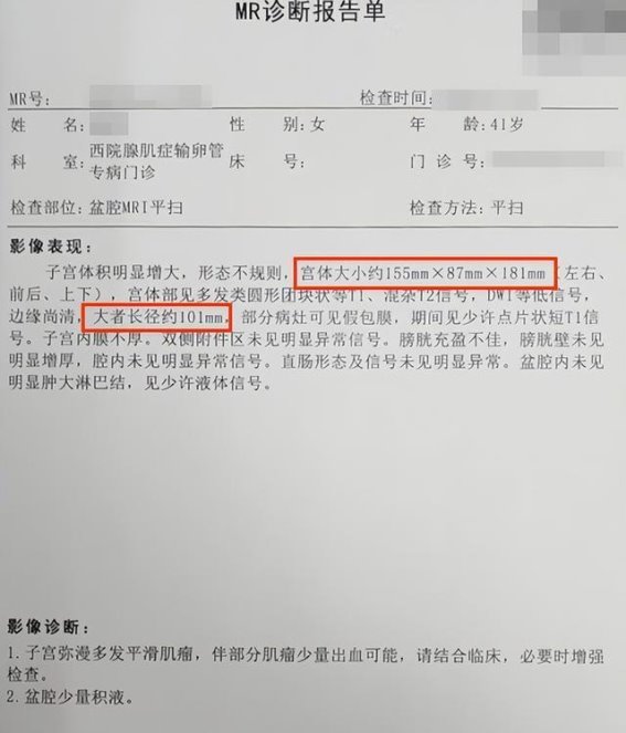 子宫肌瘤复发的抉择：四川患者的治疗经验