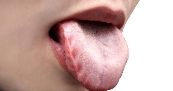 夏季多汗的健康密码：阳虚、脾虚、湿热的中医调理