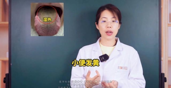 黄腻苔的两种面貌：湿热与阳虚的辨证治疗